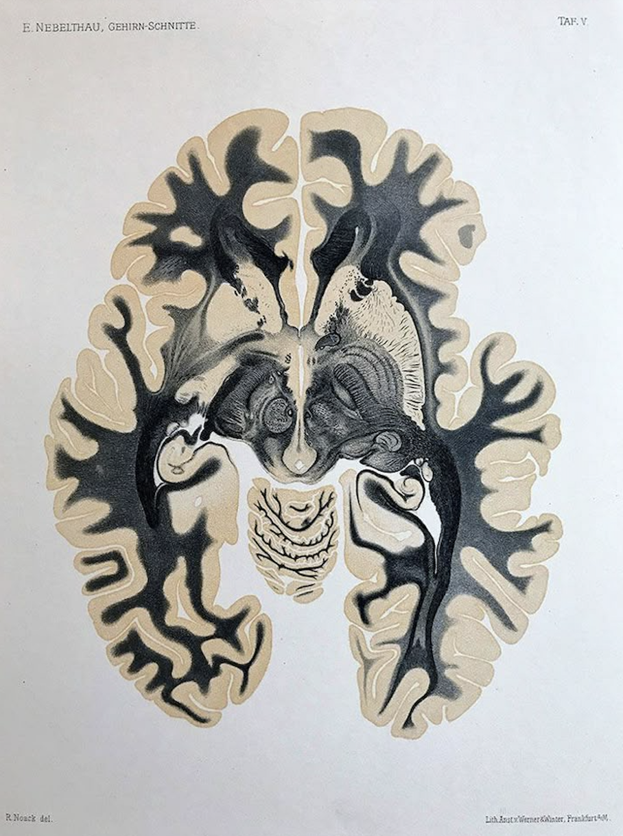 The Brain-Boosting Power of B12: What This Essential Vitamin Really Does for Your Mood and Mind
